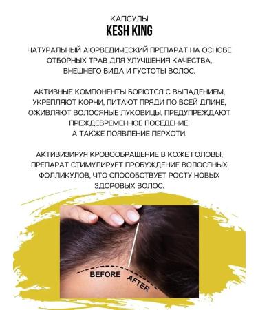Indian Hair loss remedy kash king - Buy Online on GoSupps.com