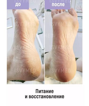 ISVYMED Stop cream with 25% urea - Buy Online on GoSupps.com