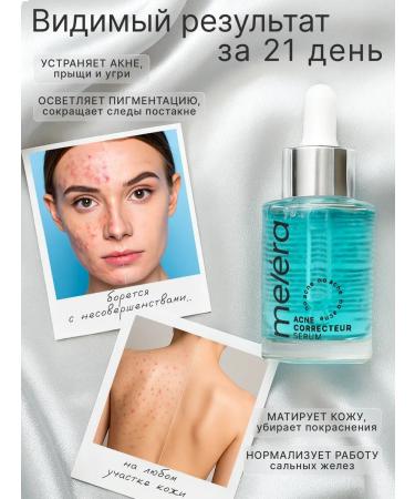 Melera Anti -acne whey against inflammation - Buy Online on GoSupps.com