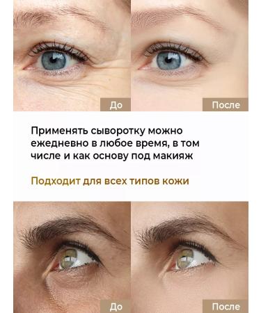 HARBEZ Wheeule for the skin around the eyes moisturizing 30 ml from wrinkles - Buy Online on GoSupps.com