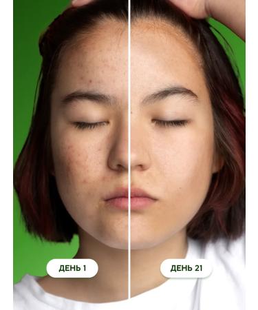 Semily Moisturizing face tonic - Buy Online on GoSupps.com