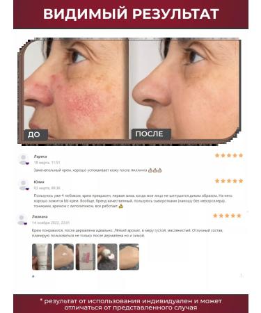 Matrigen Face cream. Anti -aging from wrinkles - Buy Online on GoSupps.com