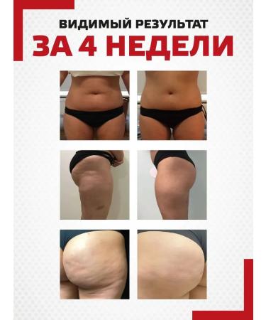 X2GEL Anti -cellulite cream for weight loss of the body fat burning - Buy Online on GoSupps.com