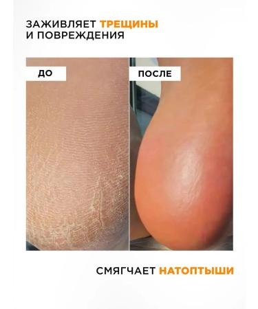 MIXIT Cream for legs and heels from cracks with urea 100 ml - Buy Online on GoSupps.com