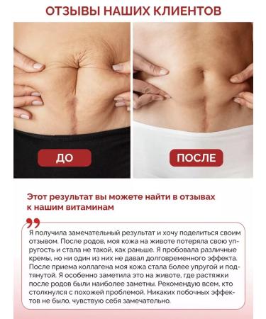 Biotte Collagen +vitamin C 3000 mg 120pcs Premium dietary - Buy Online on GoSupps.com