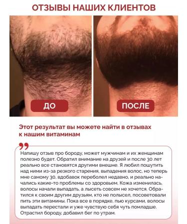 Biotte Collagen +vitamin C 3000 mg 120pcs Premium dietary - Buy Online on GoSupps.com