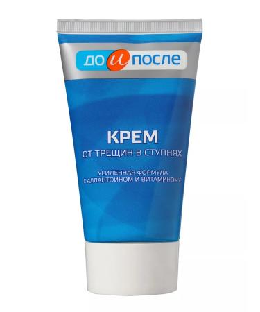 Twins Tech Feet cream from cracks in the feet to and after 150 ml - Buy Online on GoSupps.com