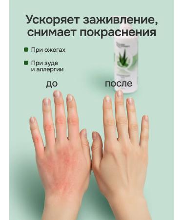 Naturalness Index Cream gel with aloe for the face and body - Buy Online on GoSupps.com