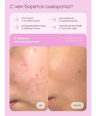 Halsa Cosmetics Facial serum with retinol and niacinamide anti -aging - Buy Online on GoSupps.com