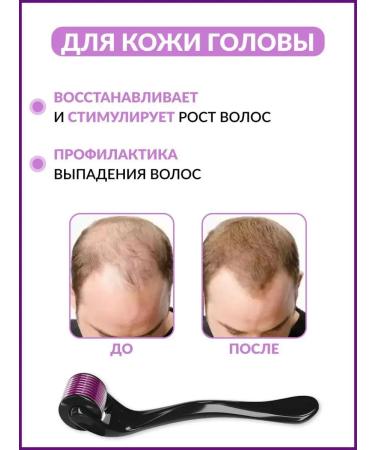 AlexOst Mesoroller 1 mm for the face and serum retinol 2% - Buy Online on GoSupps.com