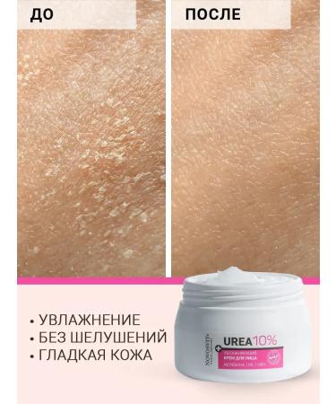 Novosvit Moisturizer of the face of urea 10% 300ml - Buy Online on GoSupps.com