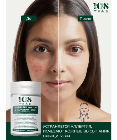 108 herbs Antiparasitar complex detox for weight loss and purification - Buy Online on GoSupps.com