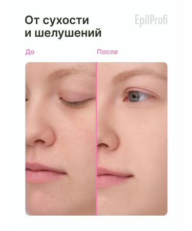 EpilProfi Facial cream of deep moisture with urea 10% 250 ml - Buy Online on GoSupps.com