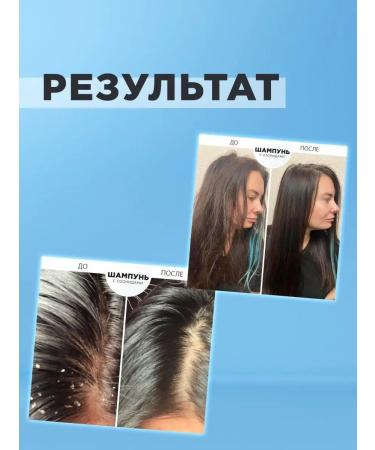 OzoneBox Hair and scalp Ozodermis healing shampoo - Buy Online on GoSupps.com