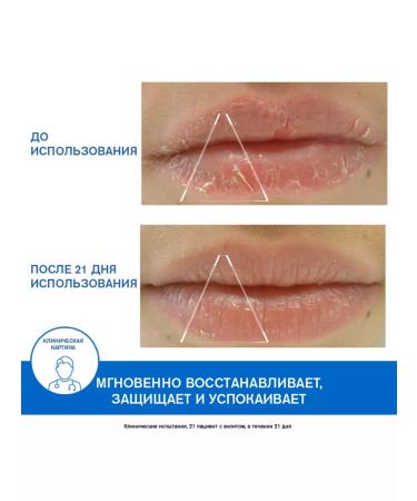 URIAGE Bariederm-cyc protecting lip balm 15 ml - Buy Online on GoSupps.com