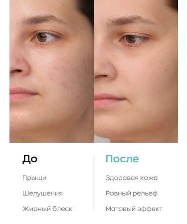 Likato professional Two -phase face tonic acne remedy 200 ml - Buy Online on GoSupps.com