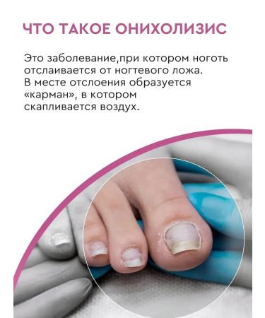 INKI Casting serum onycholysis remedy for nail treatment 30 ml - Buy Online on GoSupps.com