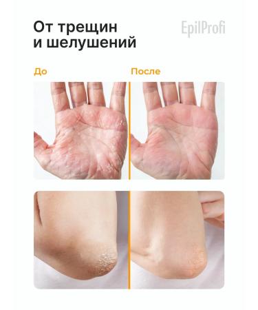 EpilProfi Cream of wax from cracks and corns for the hands and body set 3 pcs - Buy Online on GoSupps.com