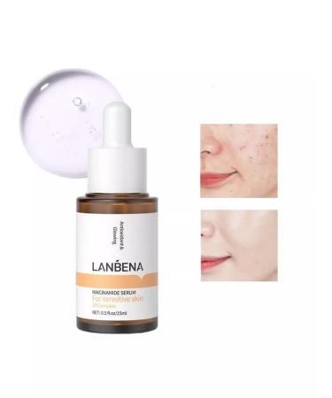 LANBENA From acne whey with niacinamide 30 ml