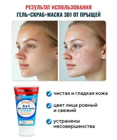 PROPELLER Gel-scrub-mask 3B1 from acne with zincidon 150 ml - Buy Online on GoSupps.com