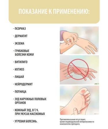 4HEALTH 10 pcs. Chinese ointment from psoriasis Zudaifu - Buy Online on GoSupps.com