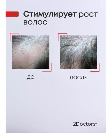 2Doctors Serum from falling out and for hair growth - Buy Online on GoSupps.com