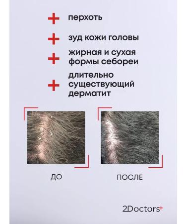 2Doctors Hair dandruff shampoo - Buy Online on GoSupps.com