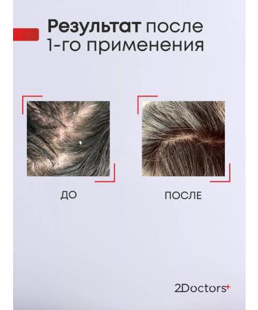2Doctors Sulsen hair dandruff - Buy Online on GoSupps.com