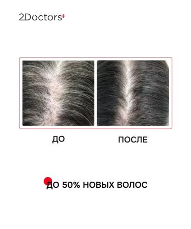 2Doctors Hair growth with red pepper - Buy Online on GoSupps.com