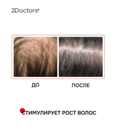 2Doctors Hair growth with red pepper - Buy Online on GoSupps.com
