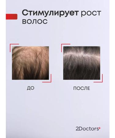 2Doctors Hair shampoo from falling out and for growth - Buy Online on GoSupps.com