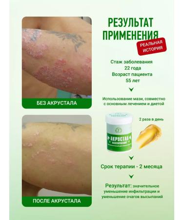 Acrustal Ointment from psoriasis is effective - Buy Online on GoSupps.com