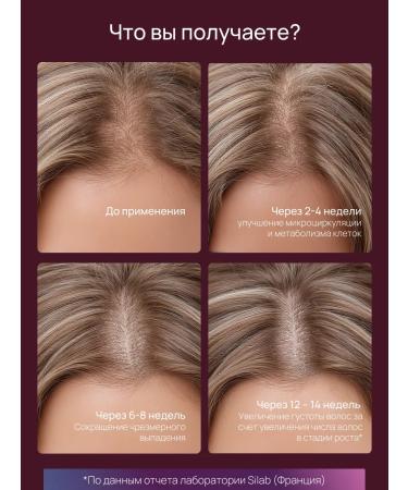 Selentsin Hair dropping shampoo set - Buy Online on GoSupps.com