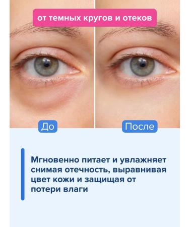 Genel Cream around the eyes from edema and dark circles - Buy Online on GoSupps.com