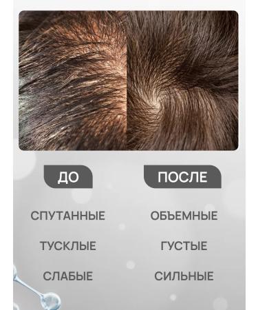 FREEDOM Male Contractor 2 in 1 Man Care 300 ml - Buy Online on GoSupps.com