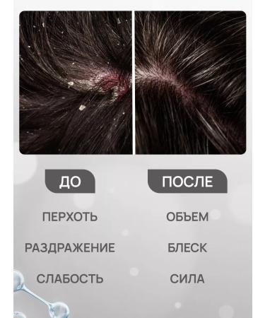 FREEDOM Shampoo men's departure to protect against Men Care 300 ml - Buy Online on GoSupps.com