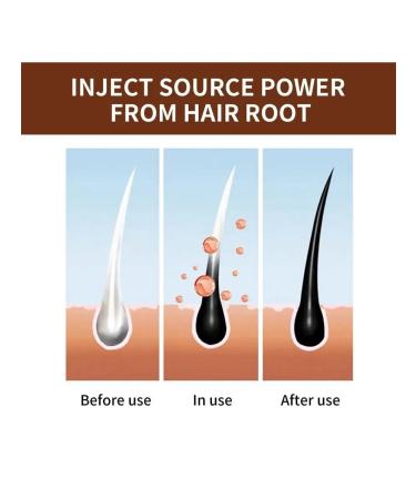 Zozu Soap from falling out and hair growth - Buy Online on GoSupps.com