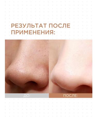 Tony Moly Face sling deep cleansing Hare cosmetics - Buy Online on GoSupps.com