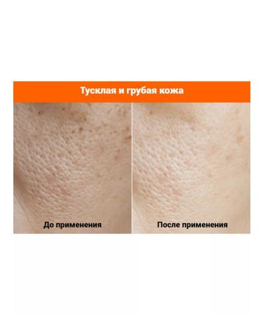 FAU Shiny Pumpkin Peel Care Cream Pilling Crem - Buy Online on GoSupps.com