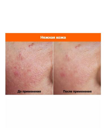 FAU Shiny Pumpkin Peel Care Cream Pilling Crem - Buy Online on GoSupps.com