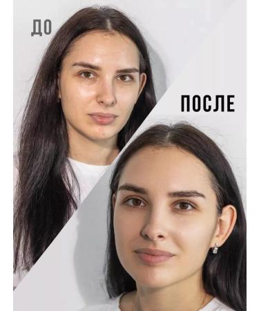 OZ OrganicZone Professional Facial cream for problem skin Anti Acne 50 ml - Buy Online on GoSupps.com