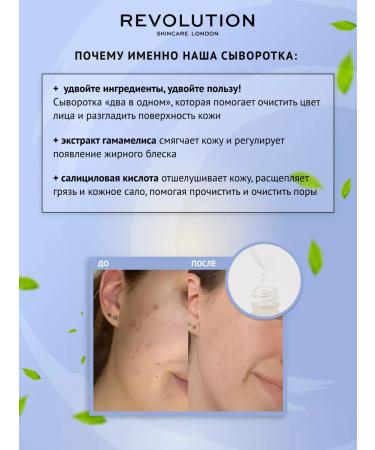 REVOLUTION SKINCARE Facial serum for oily and problem skin - Buy Online on GoSupps.com