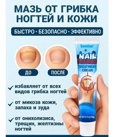 LAMIIA KING Natural ointment against nail fungus