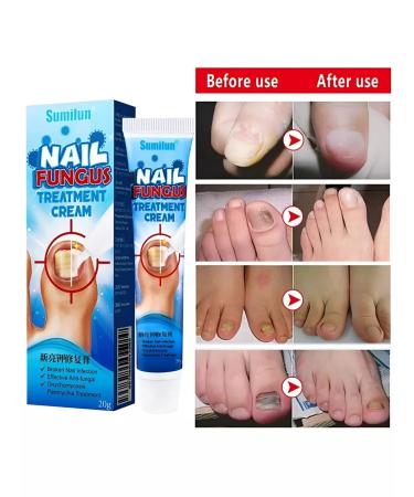 LAMIIA KING Natural ointment against nail fungus - Buy Online on GoSupps.com