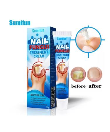 LAMIIA KING Natural ointment against nail fungus - Buy Online on GoSupps.com