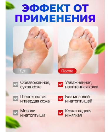 Honey and Jam Tiger Eye of Orto Feet Cream for Dry Candrels 75 ml - Buy Online on GoSupps.com