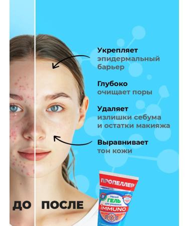 PROPELLER Gel for washing the face against acne 150ml - Buy Online on GoSupps.com