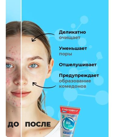 PROPELLER Gel for washing the face from acne for teenagers 150ml - Buy Online on GoSupps.com