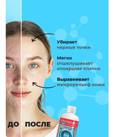 PROPELLER Facial Lotion Cleaning Acne for adolescents 210ml - Buy Online on GoSupps.com