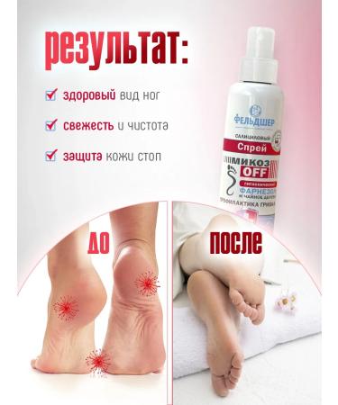 PARAMEDIC Salicylic lotion - Foot spray prevention of fungus - Buy Online on GoSupps.com